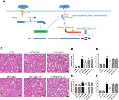 Dexmedetomidine Enhances Autophagy via α2-AR/AMPK/mTOR Pathway to Inhibit the Activation of NLRP3 Inflammasome and Subsequently Alleviates Lipopolysaccharide-Induced Acute Kidney Injury